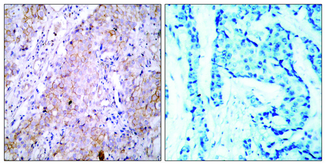 Anti-EGFR antibody produced in rabbit