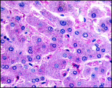Anti-DPP9 (AB1) antibody produced in