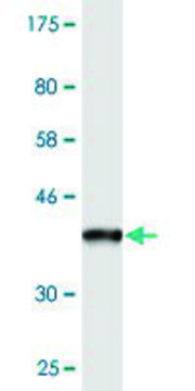 Monoclonal Anti-PPFIBP2, (N-terminal) antibody produced