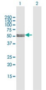 Anti-MLYCD antibody produced in rabbit