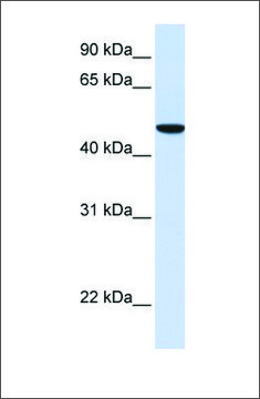 Anti-SLC2A6 antibody produced in rabbit