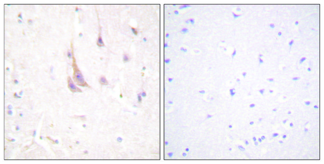 Anti-PKC ? antibody produced in