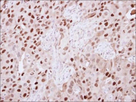 Anti-KDM6A antibody produced in rabbit