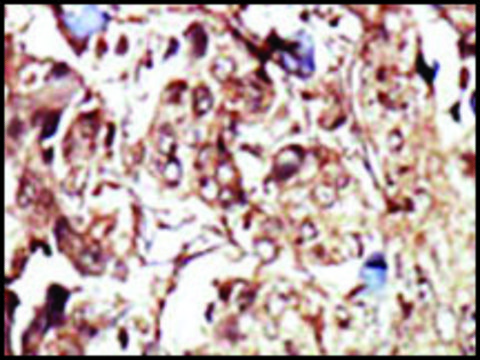 Anti-PCK2 (N-term) antibody produced in