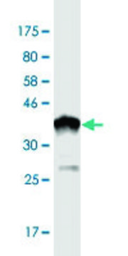 Monoclonal Anti-NARG1 antibody produced in