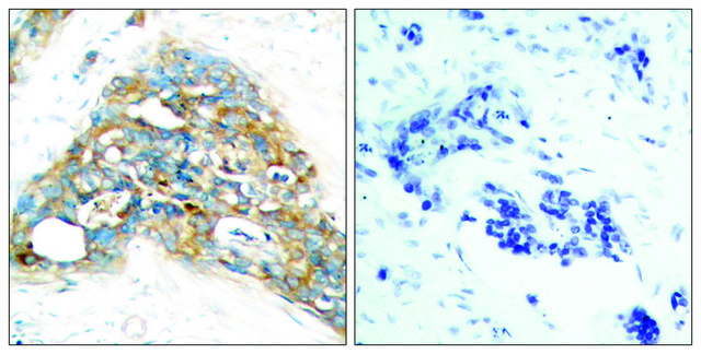 Anti-PTEN antibody produced in rabbit
