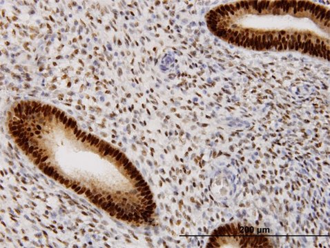Monoclonal Anti-PGR, (N-terminal) antibody produced