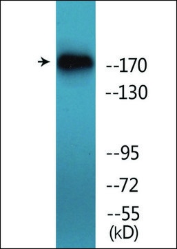 Anti-phospho-TOP2A (pSer¹¹??) antibody produced in
