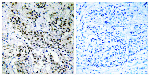 Anti-APBB2 antibody produced in rabbit