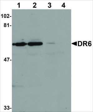 Anti-DR6 antibody produced in rabbit