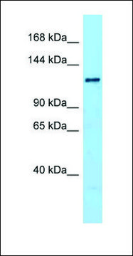 Anti-DENND1A antibody produced in rabbit