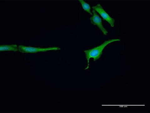 Anti-RNF14 antibody produced in rabbit