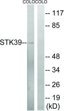 Anti-STK39 antibody produced in rabbit