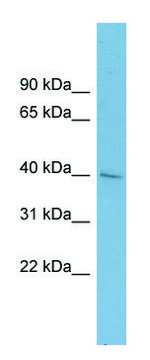 Anti-A4GALT antibody produced in rabbit