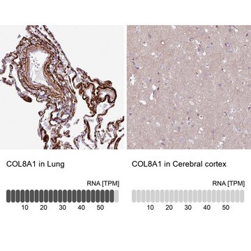Anti-COL8A1 antibody produced in rabbit