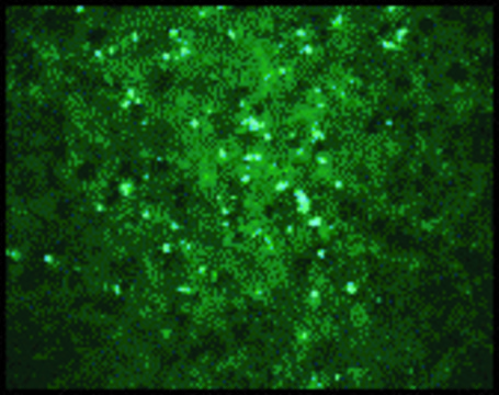 Anti-WEST NILE VIRUS CORE antibody