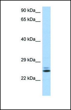 Anti-RAB15, (N-terminal) antibody produced in