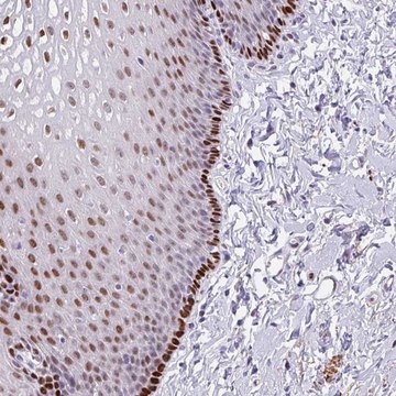 Anti-TMEM215 antibody produced in rabbit