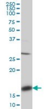Monoclonal Anti-ACP1 antibody produced in