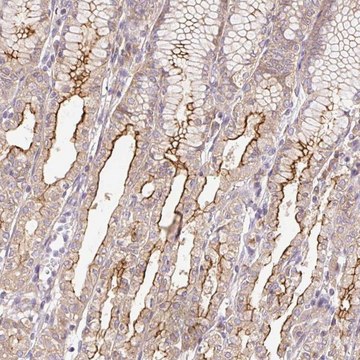 Anti-DESI1 antibody produced in rabbit