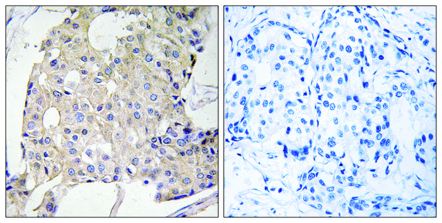 Anti-NDRG3 antibody produced in rabbit