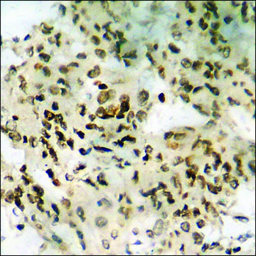 Anti-phospho-RAD51 (pTyr³¹?) antibody produced in