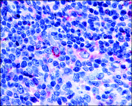 Anti-GPR65 antibody produced in rabbit