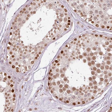 Anti-ZNF778 antibody produced in rabbit