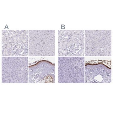 Anti-CDSN antibody produced in rabbit