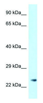 Anti-MS4A3 (N-terminal) antibody produced in