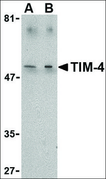 Anti-TIM-4 antibody produced in rabbit