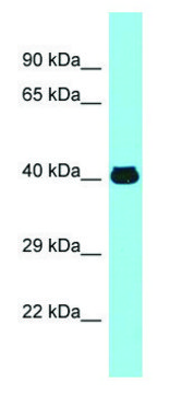 Anti-MFSD2A (N-terminal) antibody produced in