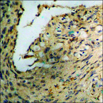 Anti-phospho-Akt (pSer??³) antibody produced in