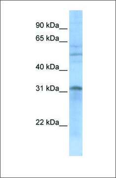 Anti-MTCH2 (ab2) antibody produced in