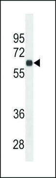 MONOCLONAL ANTI-CD138 (C-TERMINAL) antibody produced