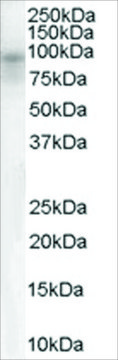 Anti-Dipeptidylpeptidase 10 antibody produced in