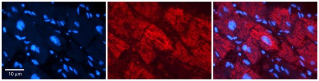Anti-NFATC1 (ab1) antibody produced in