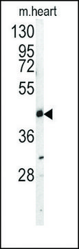 Anti-UBE1C (N-term) antibody produced in