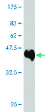 ANTI-IKBKB antibody produced in mouse