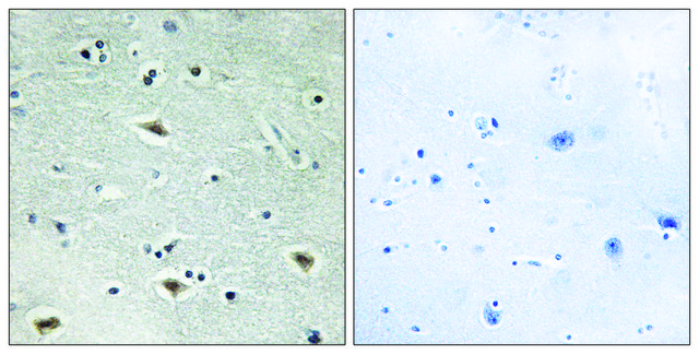 Anti-MTG16 antibody produced in rabbit
