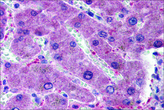 Anti-HYAL1 (ab2) antibody produced in