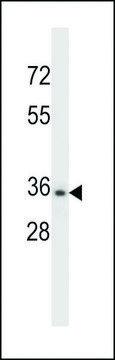 ANTI-CELA3B(N-TERMINAL) antibody produced in rabbit