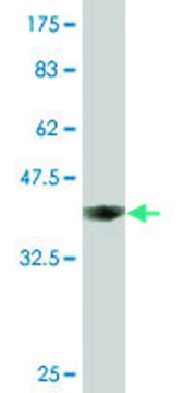 Monoclonal Anti-ACO1 antibody produced in