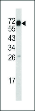 ANTI-CD105 (CENTER E395) antibody produced