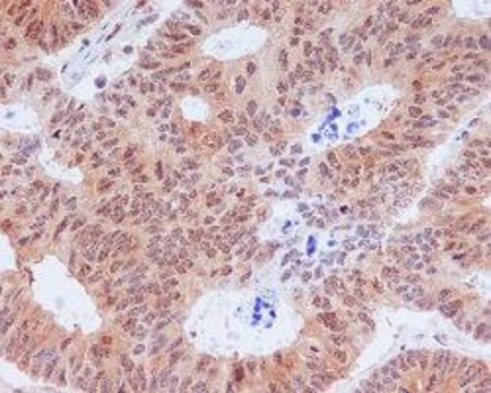 Monoclonal Anti-EIF2S1 (phospho S51) antibody