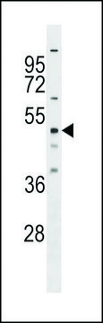 ANTI-RBM23 (CENTER) antibody produced in