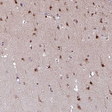 Anti-KLF16 antibody produced in rabbit