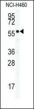 Anti-CYP21A2 (N-term) antibody produced in