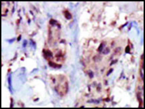 Anti-SPHK2 (C-term) antibody produced in