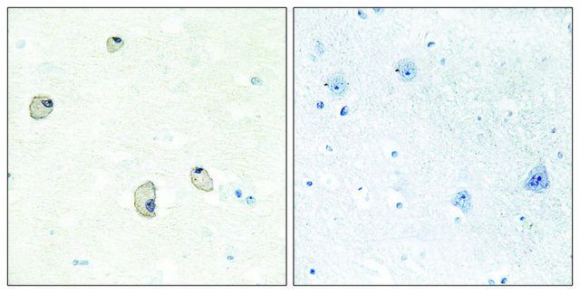 Anti-CDH22 antibody produced in rabbit